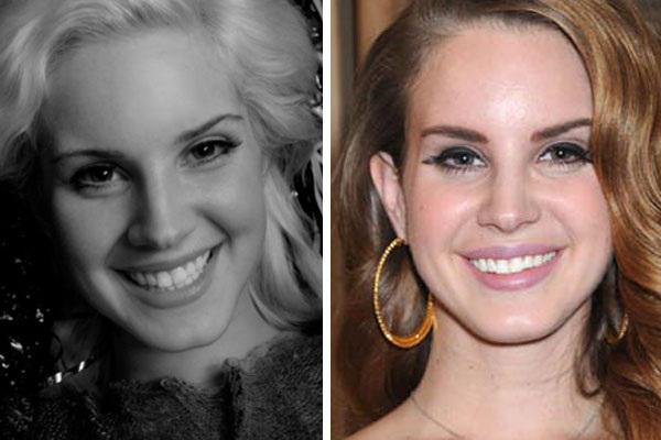 Lana Del Rey เป็นพลาสติก หน้าเปลี่ยนไปอย่างไร?