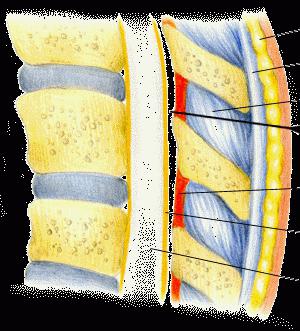 Epidural: มันคืออะไร?