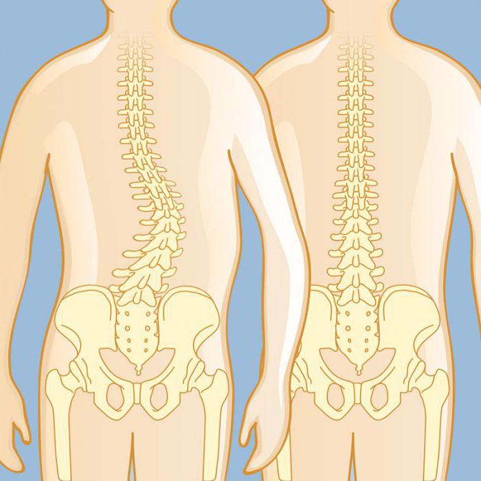 ได้อย่างรวดเร็วกำจัด scoliosis