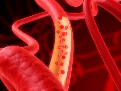 Lipidogram - มันคืออะไร? วิธีการถอดรหัส lipidogram?