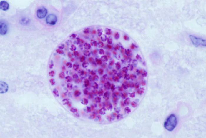 toxoplasma igg 