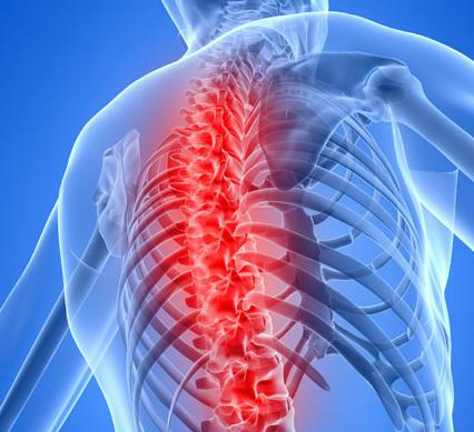 Thoracalgia vertebrogenic